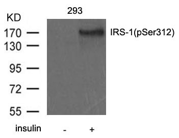 Anti-Phospho-IRS-1 (Ser312) Polyclonal Antibody