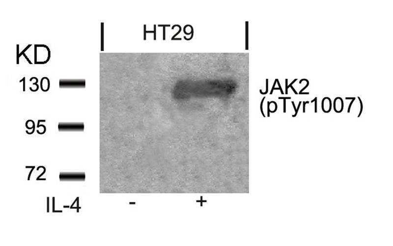 Anti-Phospho-JAK2 (Tyr1007) Polyclonal Antibody