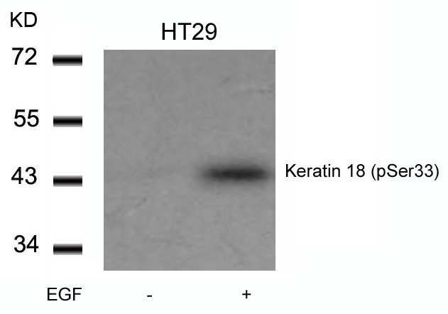 Anti-Phospho-KRT18 (Ser33) Polyclonal Antibody
