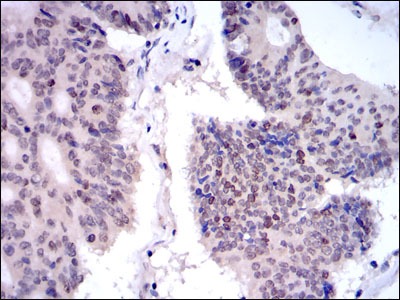 Anti-GJB2 Antibody (8X956)