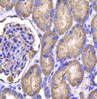 Anti-Isocitrate dehydrogenase/IDH1 Antibody (9Q57)