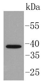 Anti-ISL1 Antibody (8S951)