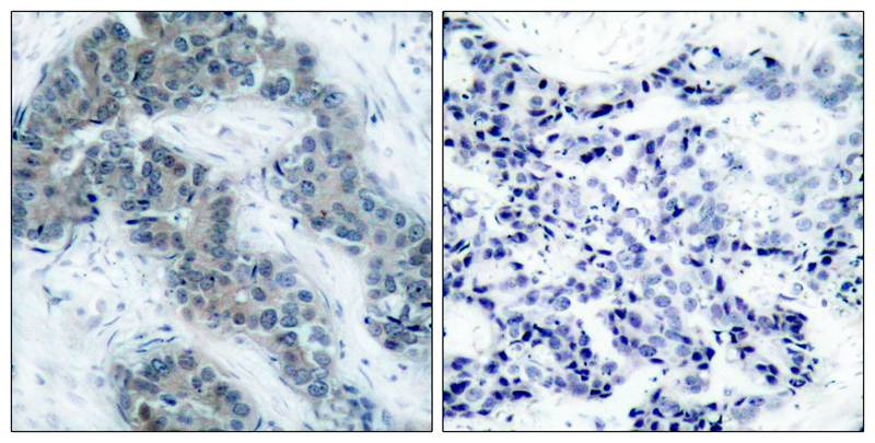 Anti-Phospho-JAK2 (Tyr1007) Polyclonal Antibody