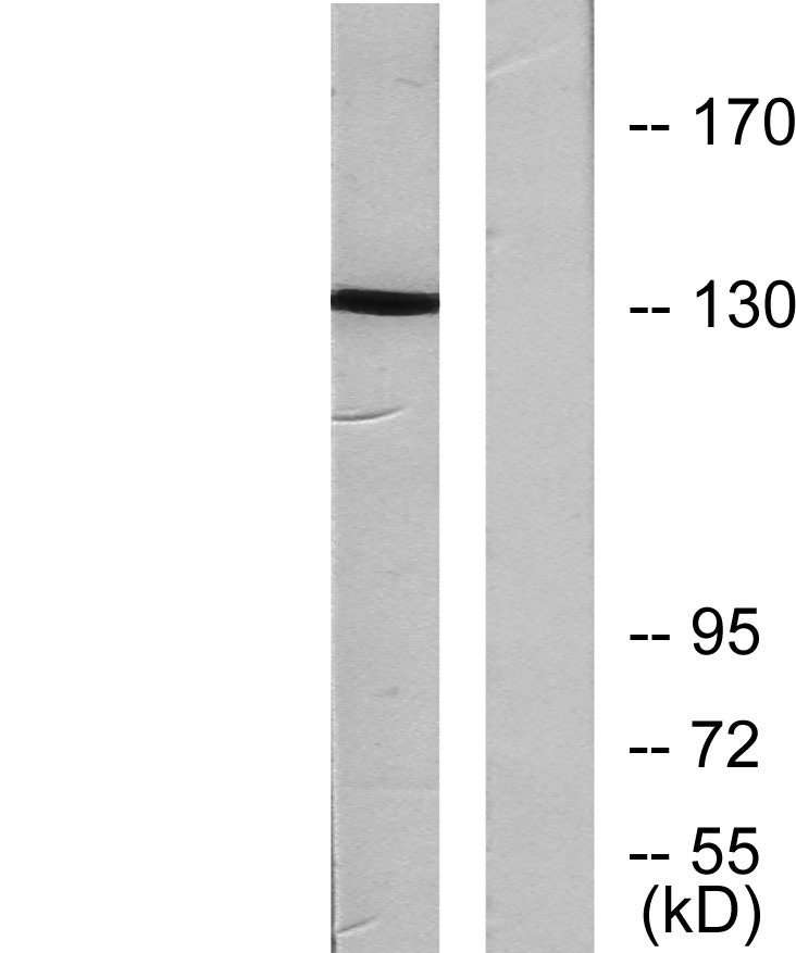 Anti-Phospho-JAK1 (Tyr1022) Polyclonal Antibody