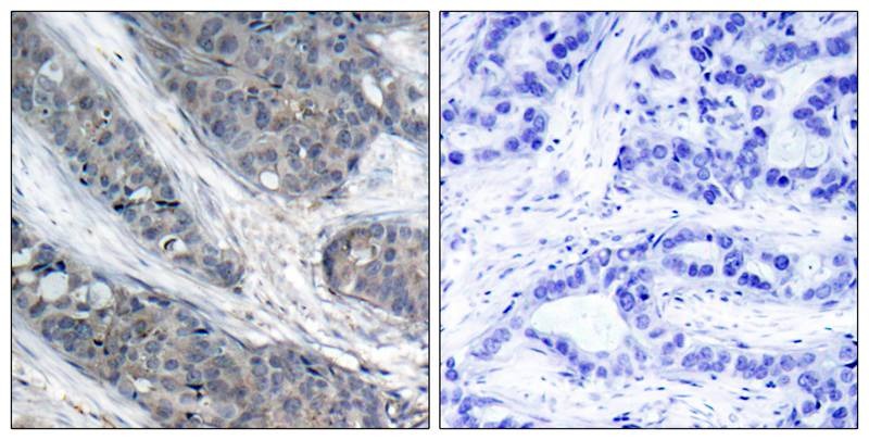Anti-Phospho-IRS-1 (Ser307) Polyclonal Antibody