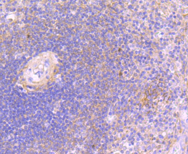 Anti-JAK3 Antibody (5S507)