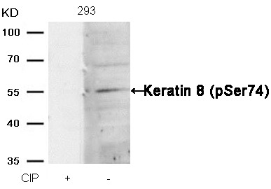Anti-Phospho-KRT8 (Ser74) Polyclonal Antibody