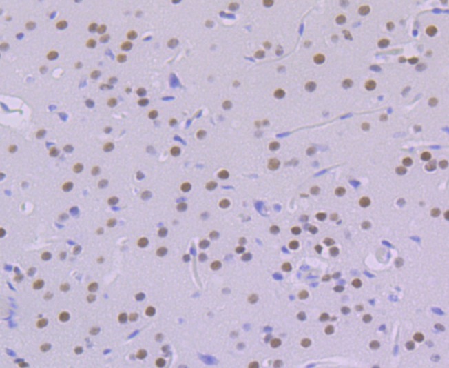 Anti-KHSRP Antibody (6L572)