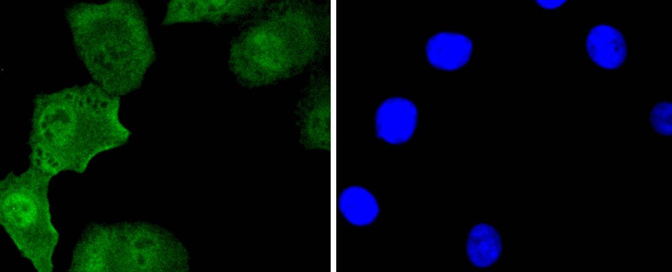 Anti-ISL1 Antibody (8S951)