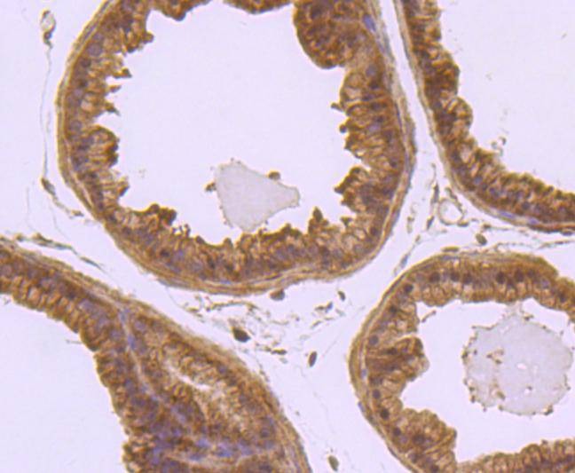 Anti-LAMB1 Antibody (6K439)