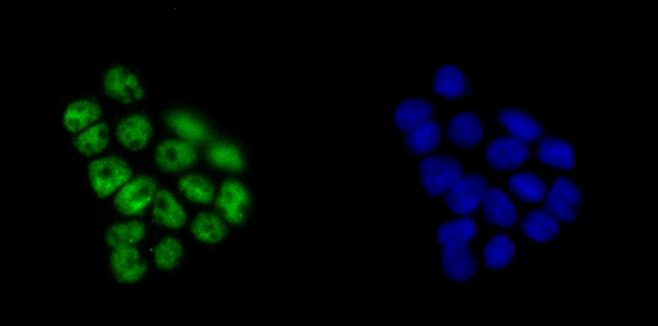 Anti-KHSRP Antibody (6L572)