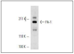 Anti-VEGFR2/KDR Antibody (6F458)