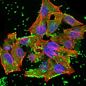 Anti-JARID2 Antibody (7C209)