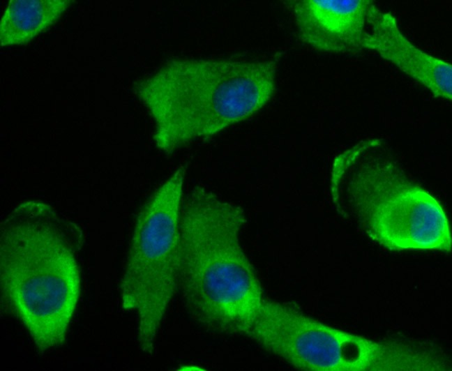 Anti-Niemann Pick C1/NPC1 Antibody (1B891)