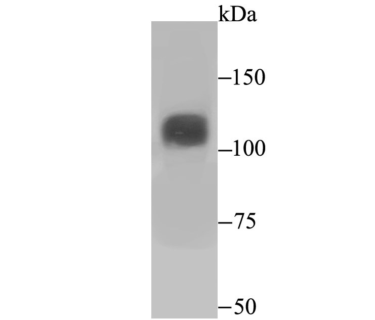 Anti-Niemann Pick C1/NPC1 Antibody (1B891)