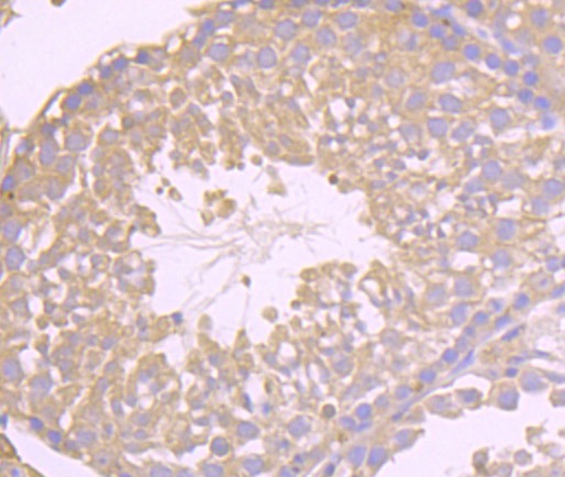 Anti-Niemann Pick C1/NPC1 Antibody (1B891)