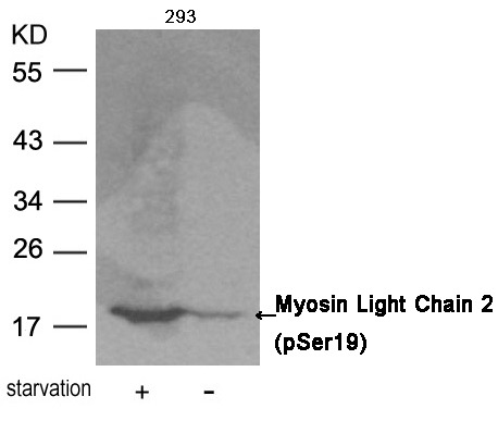 Anti-Phospho-MYL9 (Ser19) Polyclonal Antibody