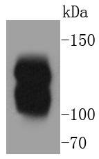 Anti-MYLK Antibody (1W61)