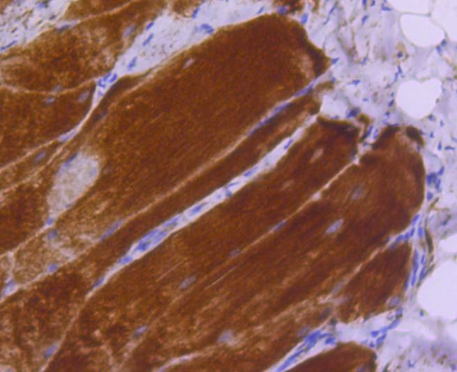 Anti-MYLK Antibody (1W61)