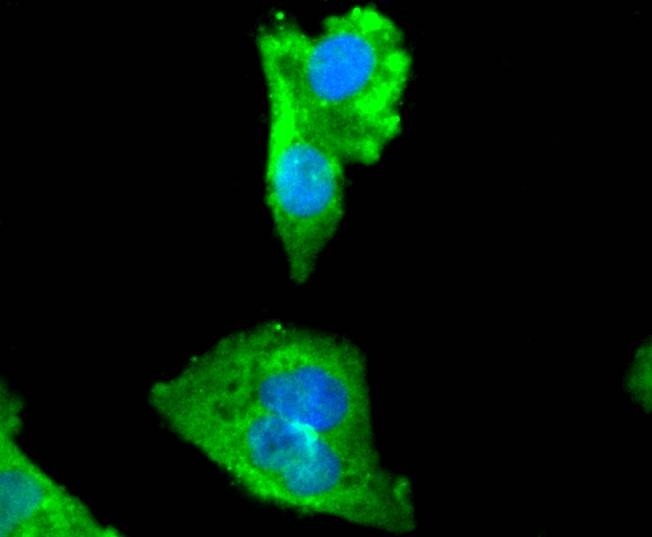 Anti-MYLK Antibody (1W61)