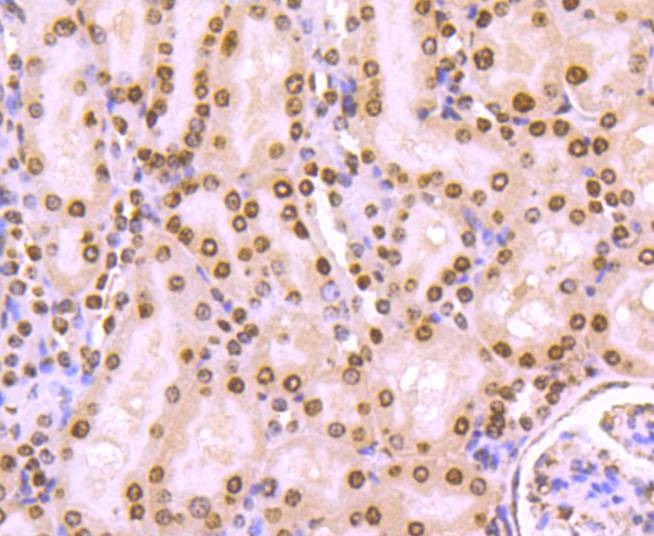 Anti-Tri-methyl-Histone H4 (Lys20) Antibody (5D958)