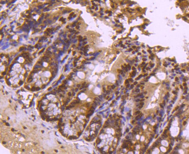 Anti-Tri-methyl-Histone H4 (Lys20) Antibody (5D958)