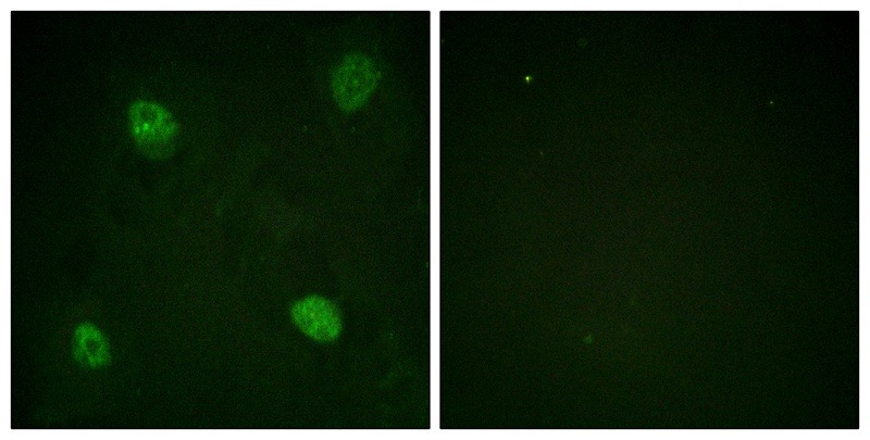 Anti-Phospho-HNRPD (Ser83) Polyclonal Antibody