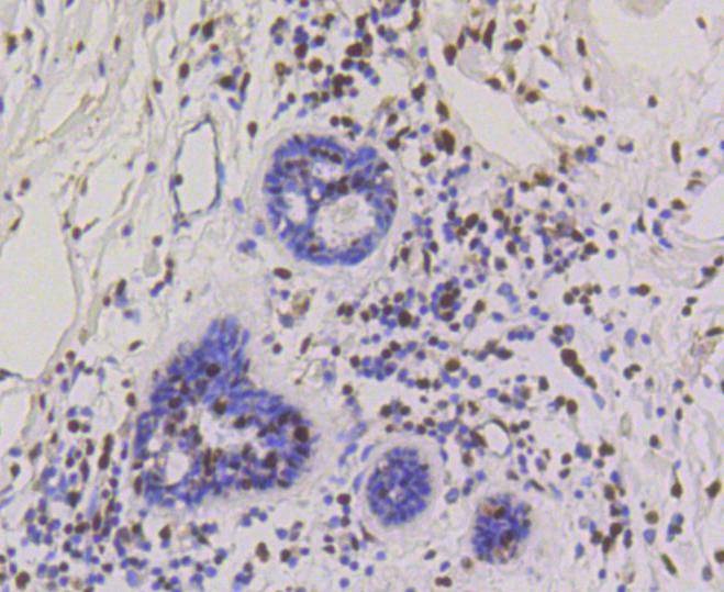 Anti-CBX5 Antibody (5G758)
