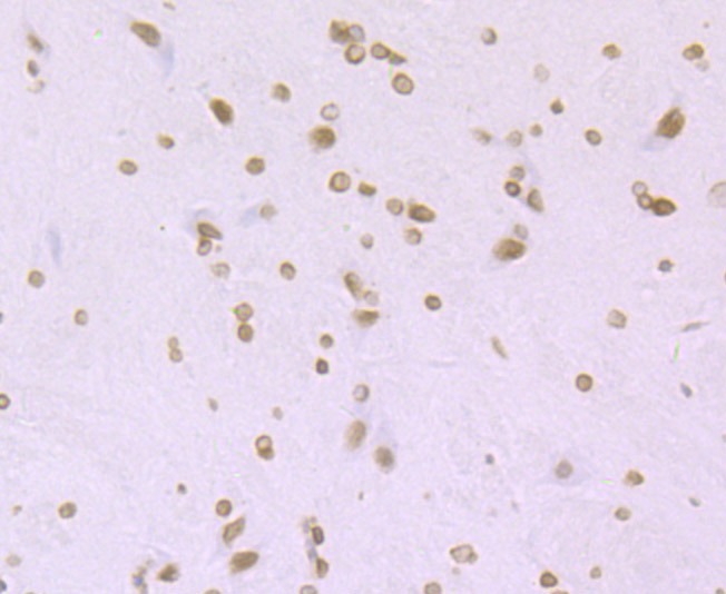 Anti-Acetyl-Histone H4 (Lys16) Antibody (5P883)