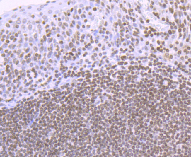 Anti-Acetyl-Histone H4 (Lys16) Antibody (5P883)