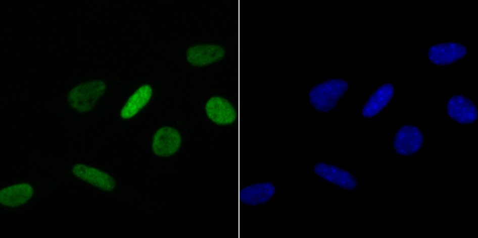 Anti-Acetyl-Histone H4 (Lys16) Antibody (5P883)