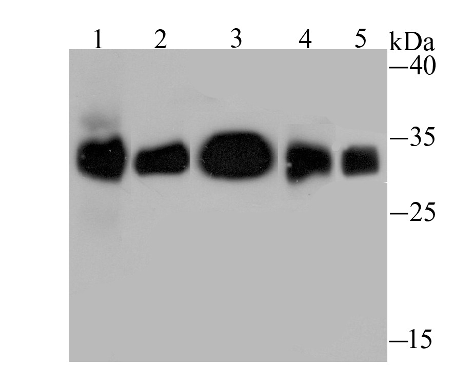 Anti-HLA-DQA1 Antibody (6J773)