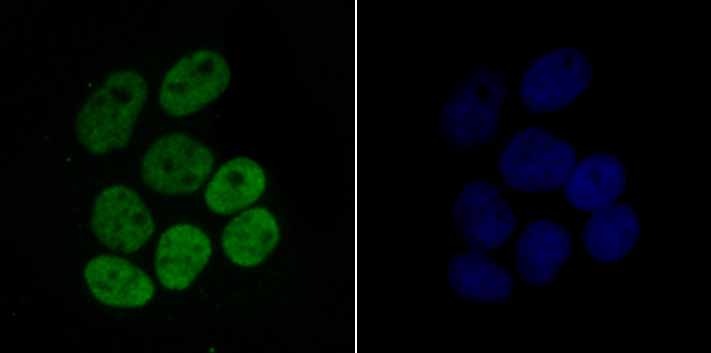 Anti-Acetyl-Histone H4 (Lys16) Antibody (5P883)