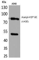 Anti-Acetyl-HSP90AA1 (Lys435) Polyclonal Antibody