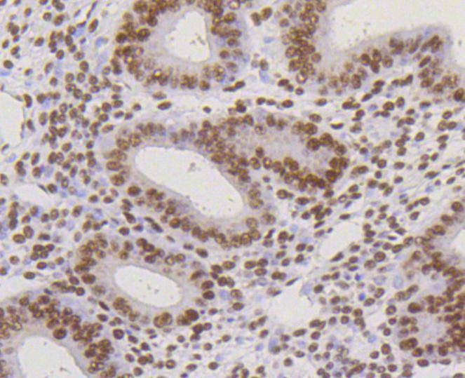 Anti-CBX5 Antibody (5G758)