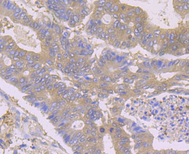 Anti-HGPRT Antibody (2V553)