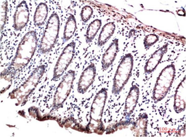 Anti-CBX3 Antibody (1M6)