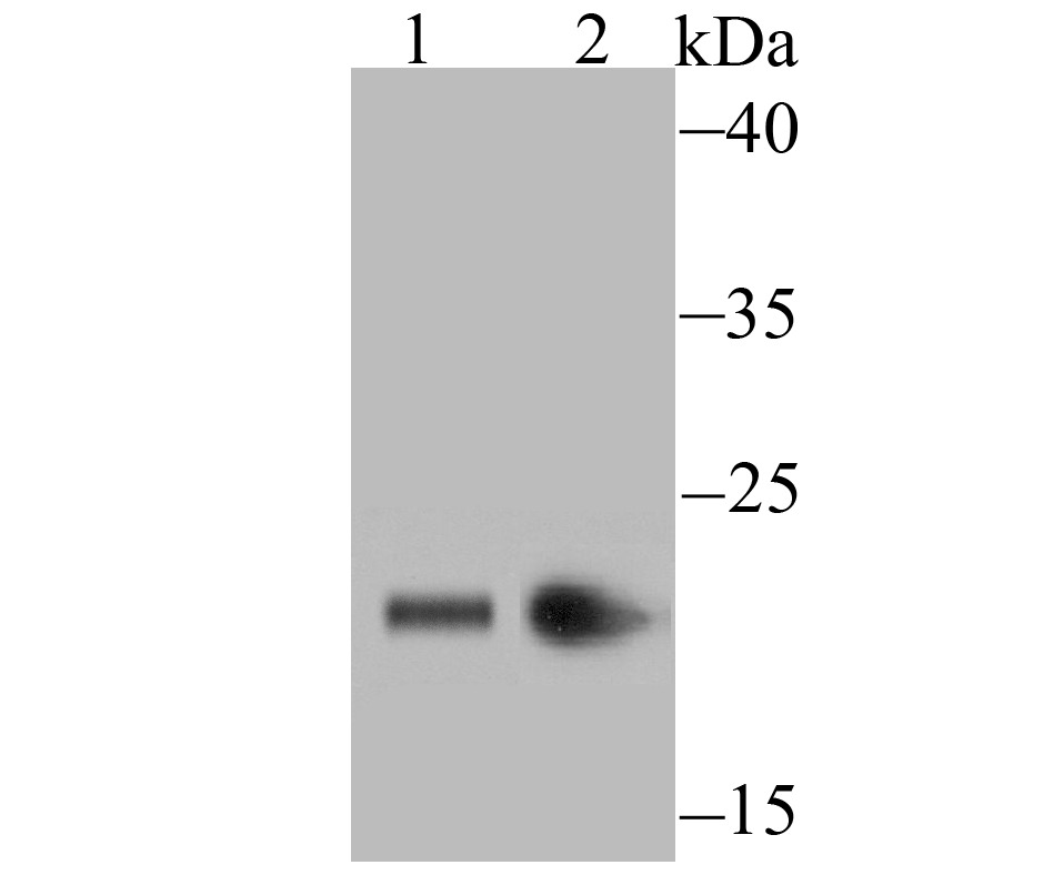Anti-CBX3 Antibody (8Z290)