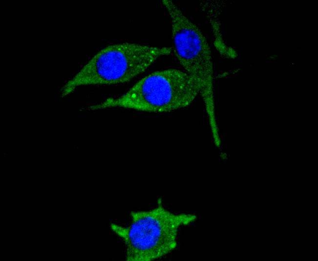 Anti-HSPB8 Antibody (1K143)