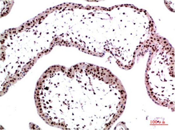Anti-CBX3 Antibody (5C615)