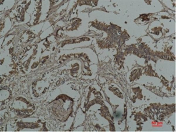 Anti-Hsp27/HSPB1 Antibody (9E653)