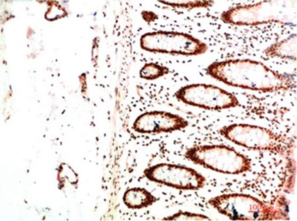 Anti-CBX5 Antibody (6Z70)