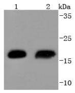 Anti-HSP20 Antibody (5R128)