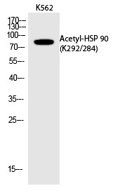 Anti-Acetyl-HSP90AA1 (Lys292, 284) Polyclonal Antibody
