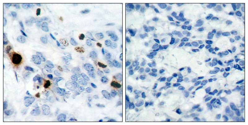 Anti-Phospho-HIST1H3A (Ser10) Polyclonal Antibody