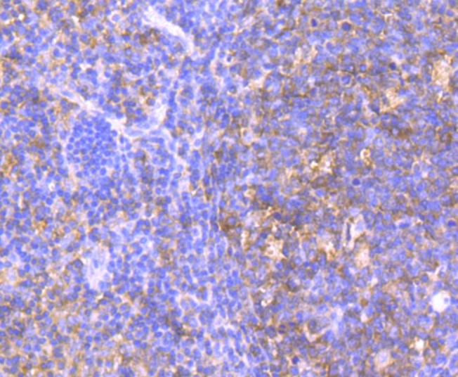 Anti-HGPRT Antibody (2V553)
