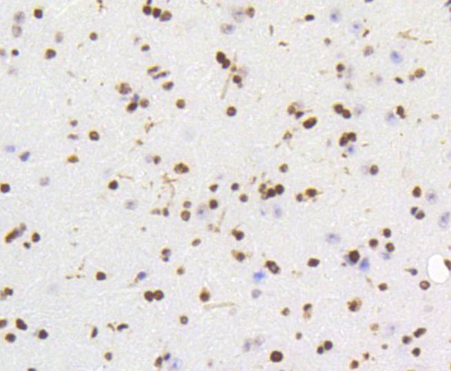 Anti-HMGB1 Antibody (5H227)