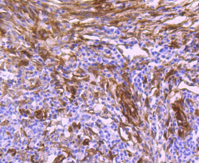 Anti-Hsp27/HSPB1 Antibody (5Q970)