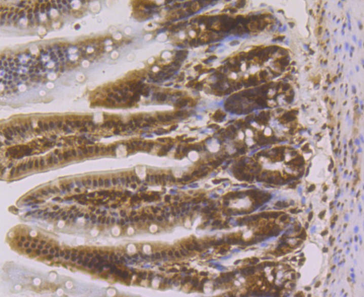 Anti-CBX3 Antibody (8Z290)