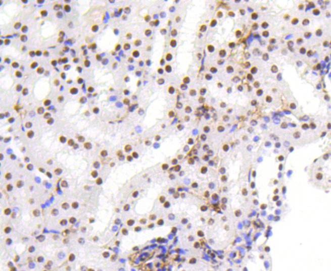Anti-HMGB1 Antibody (5H227)
